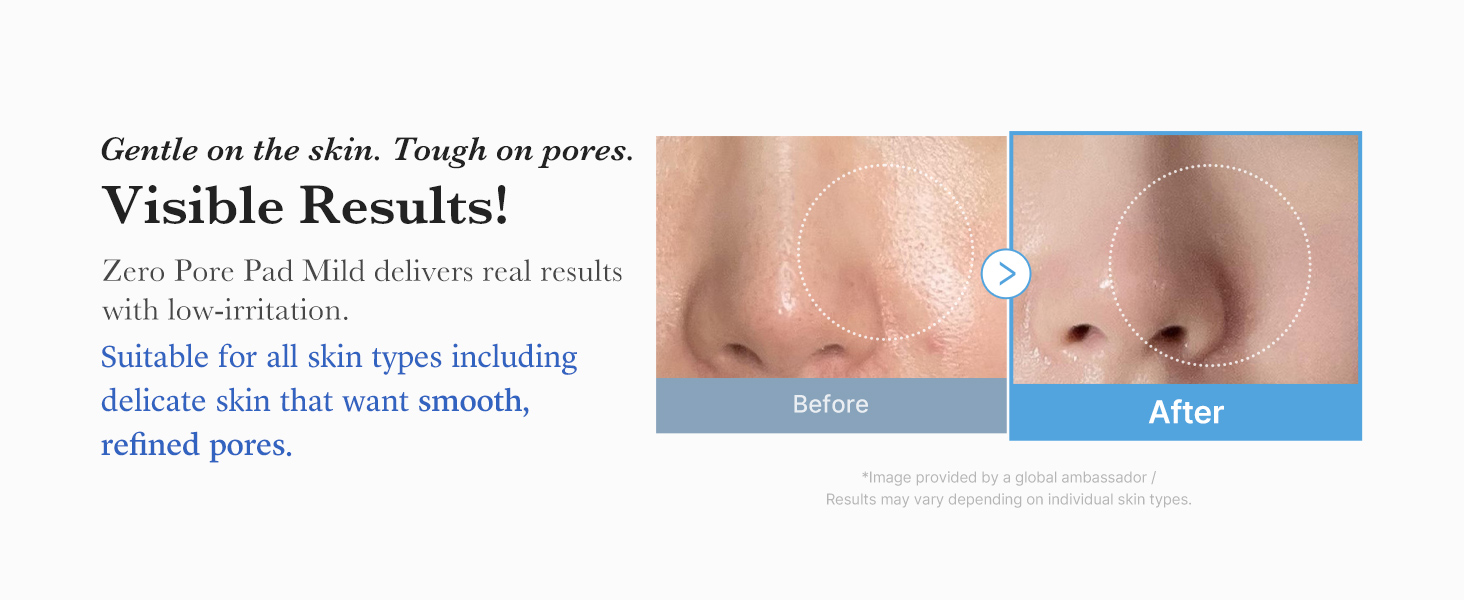 Zero Pore Pads Mild 2.0 product detail 5